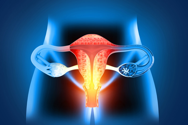 Digital-illustration-of-female-reproductive-system-treated-for-intestinal-prolapse
