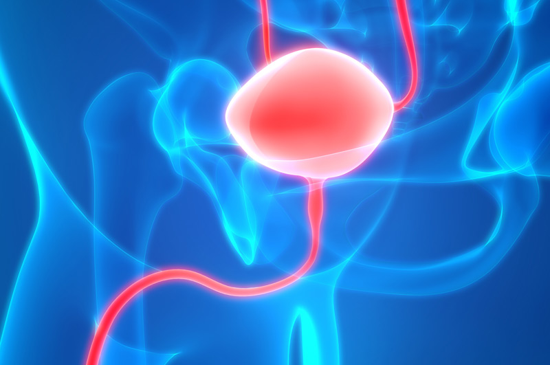 Illustration-of-bladder-that-may-form-bladder-stones