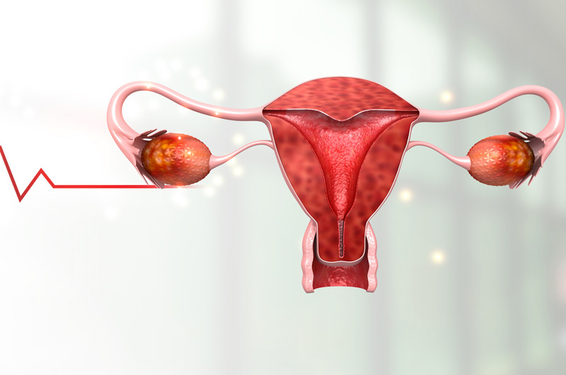 Illustration-of-female-reproductive-system-affected-by-vaginal-septum