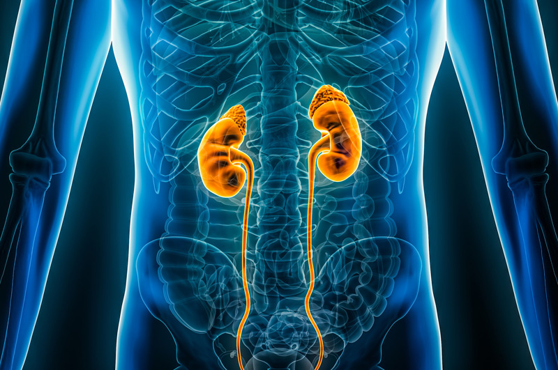 Illustration-of-kidneys-with-ureteral-obstruction