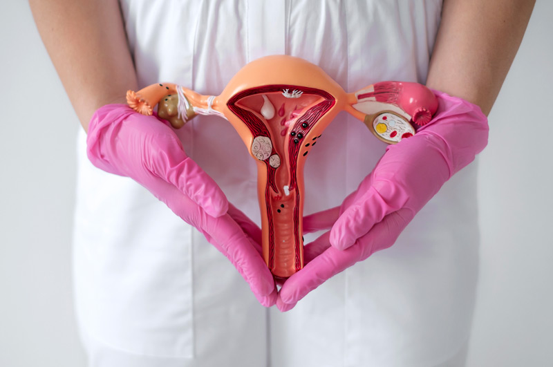 Model-of-female-reproductive-system-affected-by-pelvic-organ-prolapse