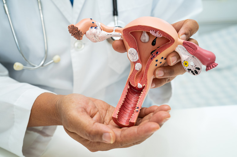 Doctor-holding-model-of-female-reproductive-system-treated-with-fistula-repair