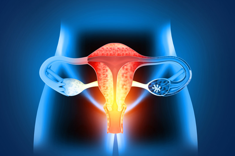 Illustration-of-female-reproductive-system-treated-with-native-tissue-prolapse-repair